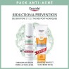 Pack Anti-Acné Expert Eucerin Dermopure Triple Action Sérum 40ml + Sun Crème SPF50+ 50ml
